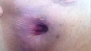 ���েষ্টা এটা করা, পায়ু, বাইরে